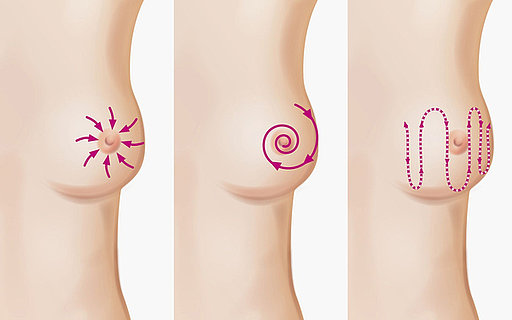 Grafik zu verschiedenen Vorgehensweisen bei der Selbstuntersuchung der Brust